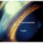 Normaler Kammerwinkel