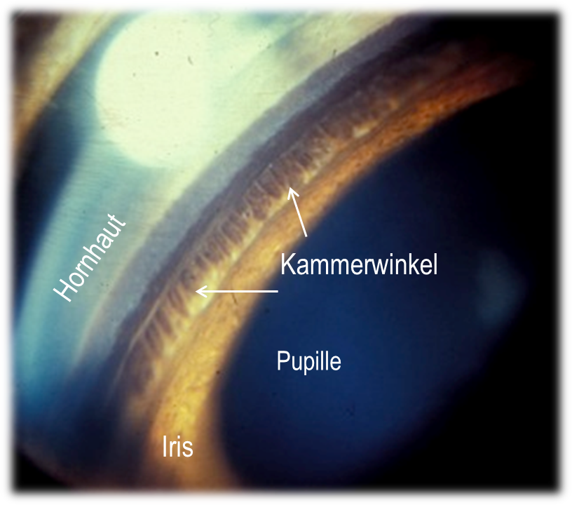 Normaler Kammerwinkel