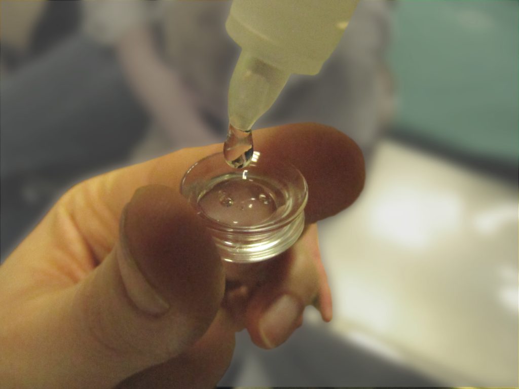 Gonioskopie - Untersuchung des Kammewinkels