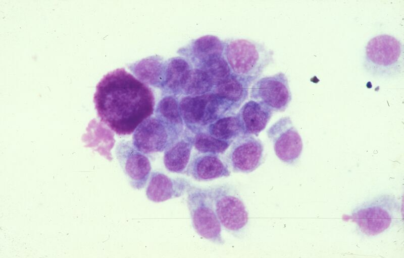 Untersuchung einer zytologischen Probe