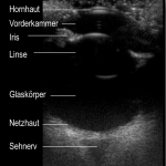 Ultaschalluntersuchung des Auges