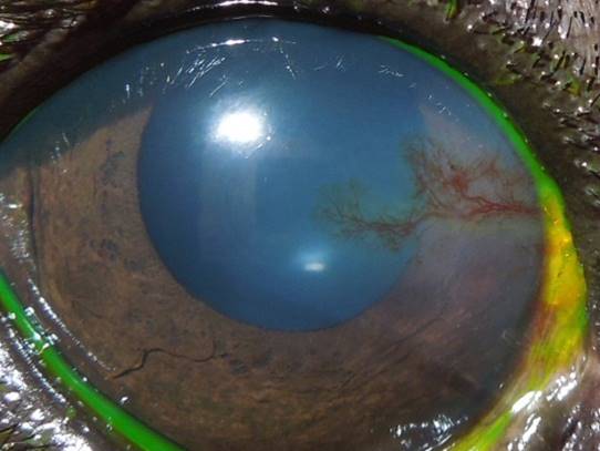 pigmentierenden Hornhautentzündung