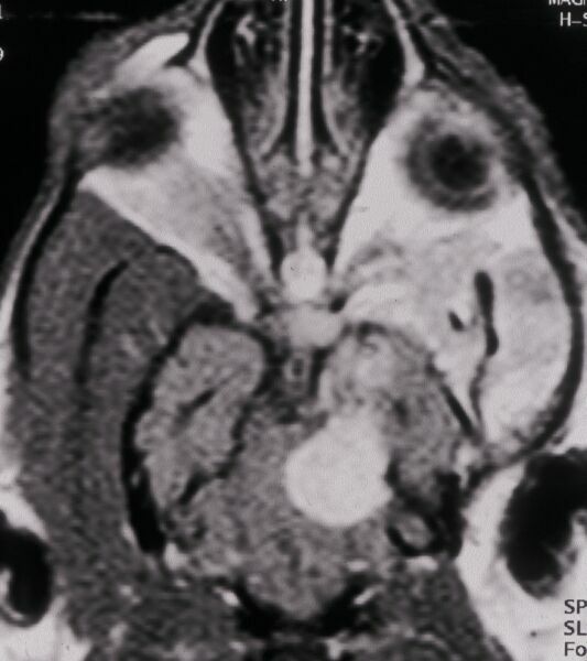 Kernspintomographie Augen-Tierarztpraxis