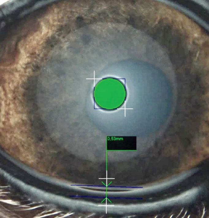 Tear Meniscus Vorschau