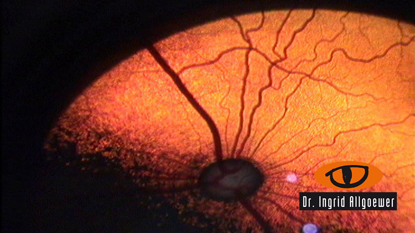 Banner Image Auge Orange